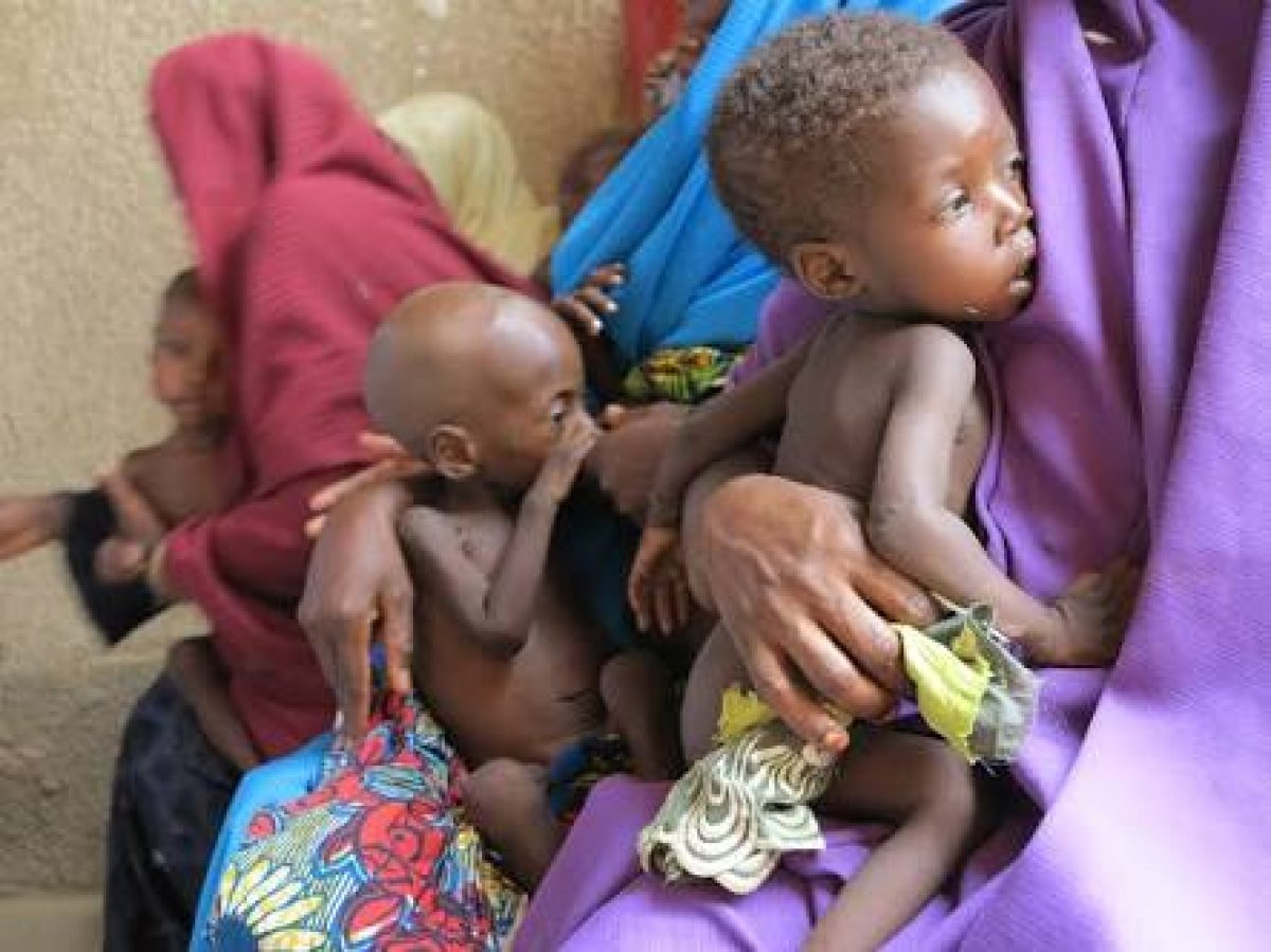 Kaduna releases N100 million for treatment of malnourished children