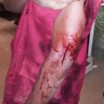 Oyo: 4 Amotekun operatives hacked, admitted into intensive care