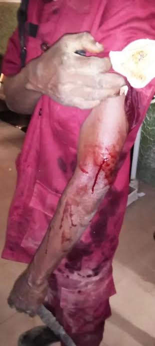 Oyo: 4 Amotekun operatives hacked, admitted into intensive care