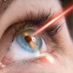 EYE