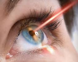 EYE
