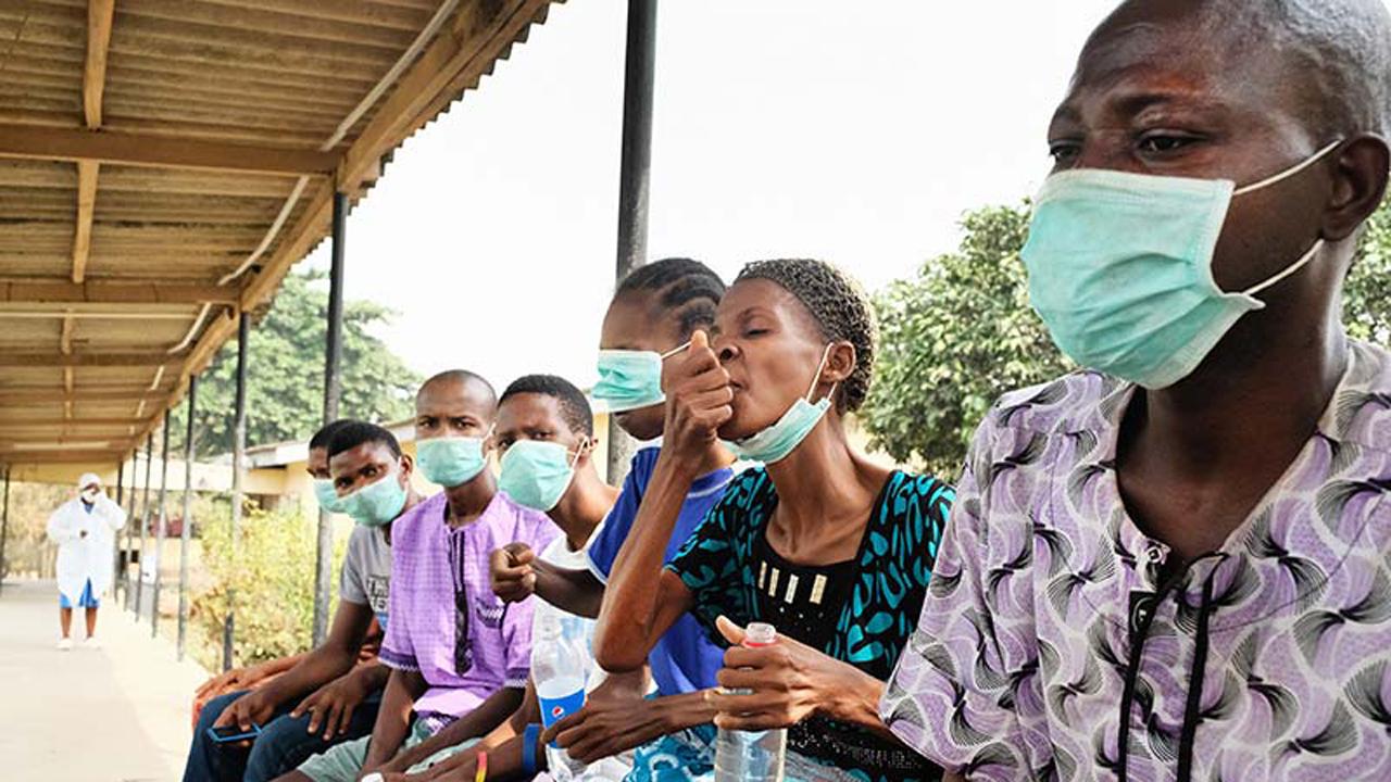 FMoH seeks partnership with media on Tuberculosis awareness