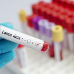 lassa-virus-750×375