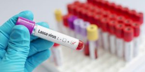 lassa-virus-750×375