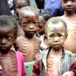 Malnutrition-children-300×233