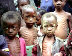 Malnutrition-children-300×233