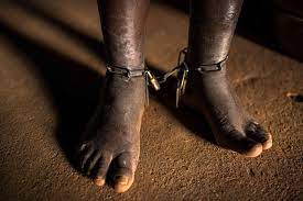 Show compassion to curb stigmatisation of mental illness – Neuro-Psychiatrist counsels