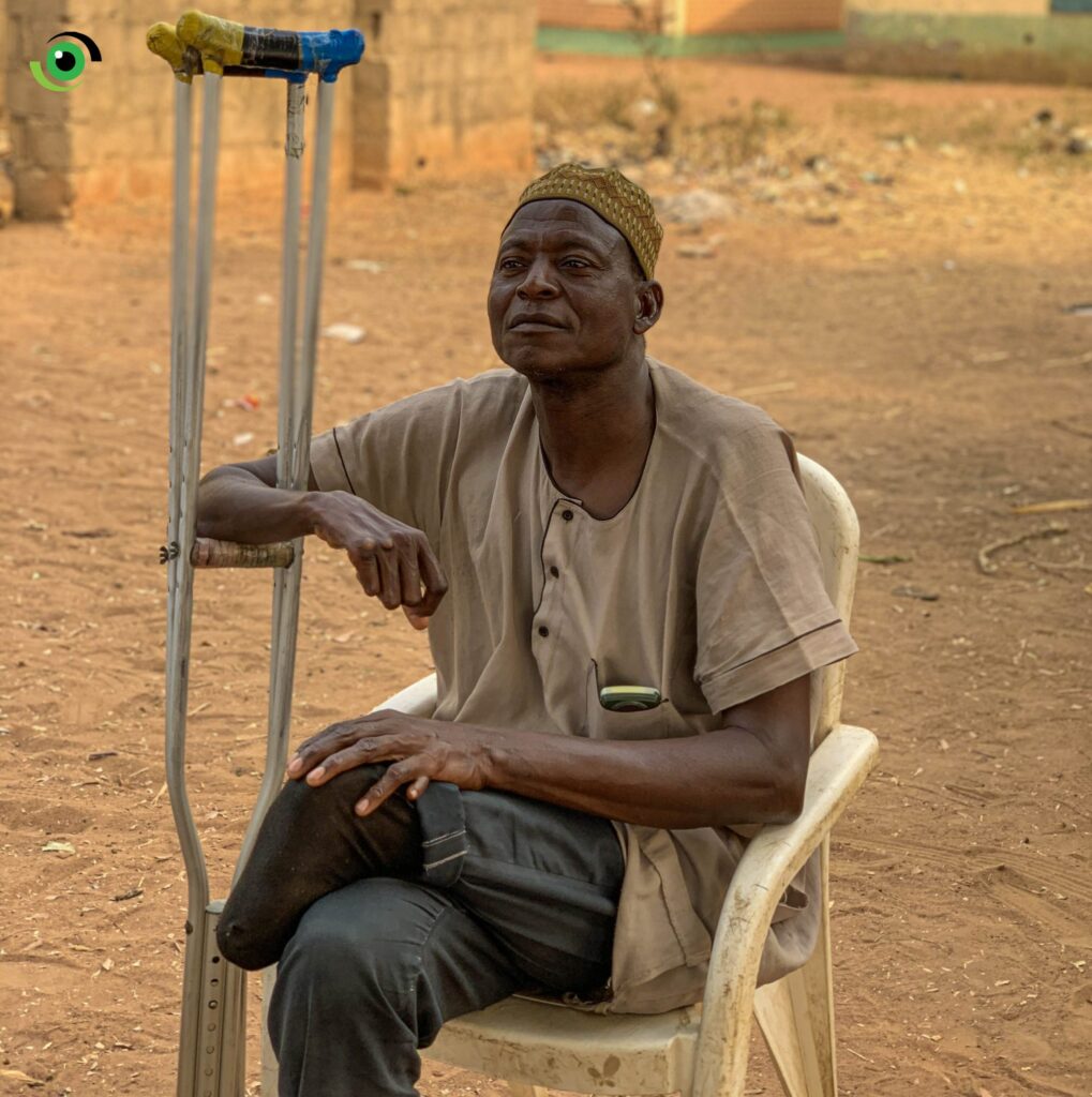 Mission calls for an end to leprosy in Nigeria