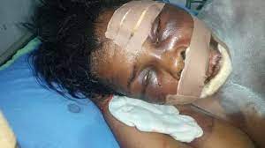 Suspected ritualists pluck out lady’s eyes in Delta