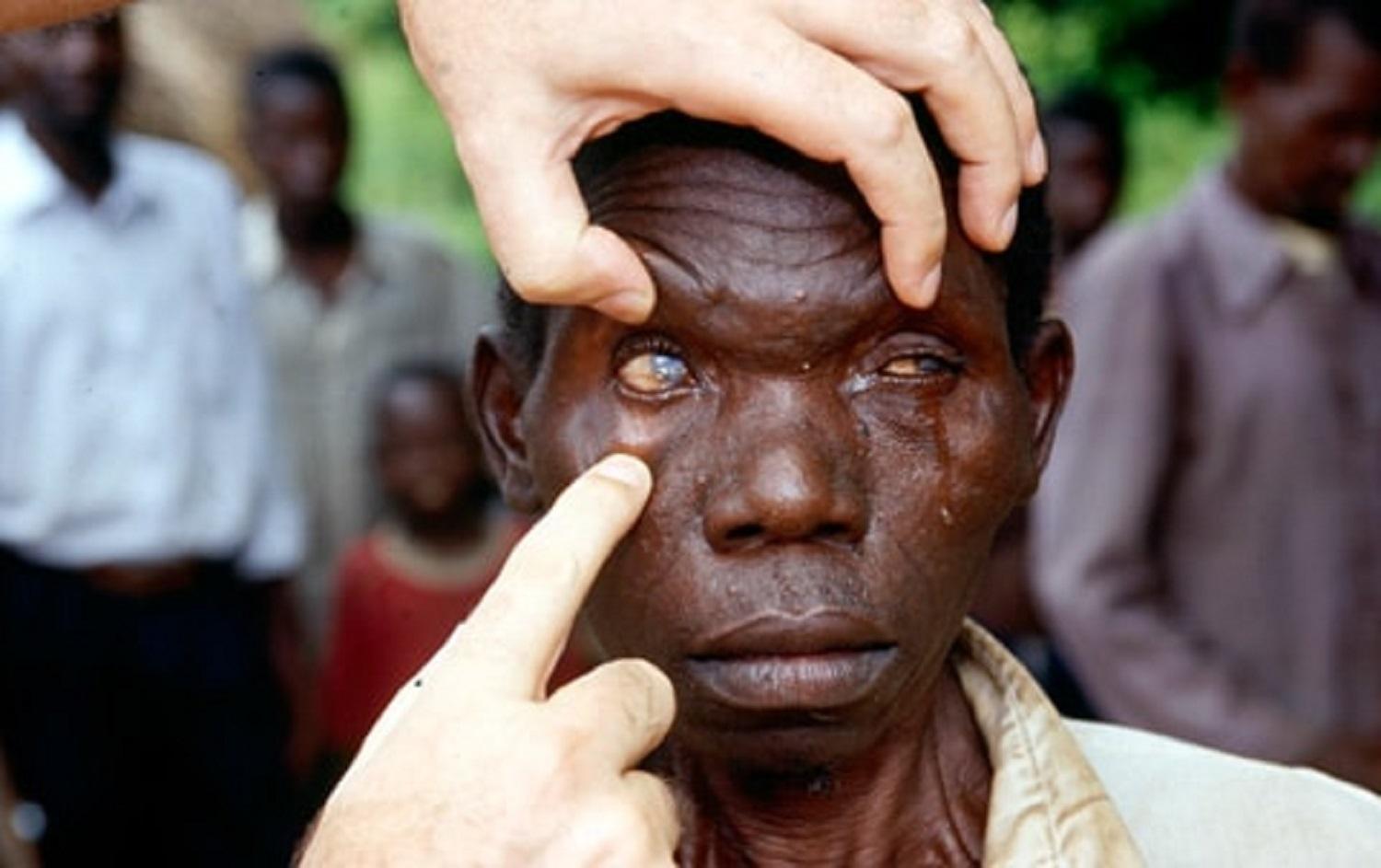 blind