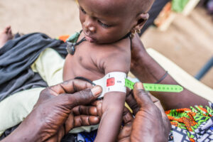 Katsina: USAID, UNICEF, others tackle Severe Acute Malnutrition in children