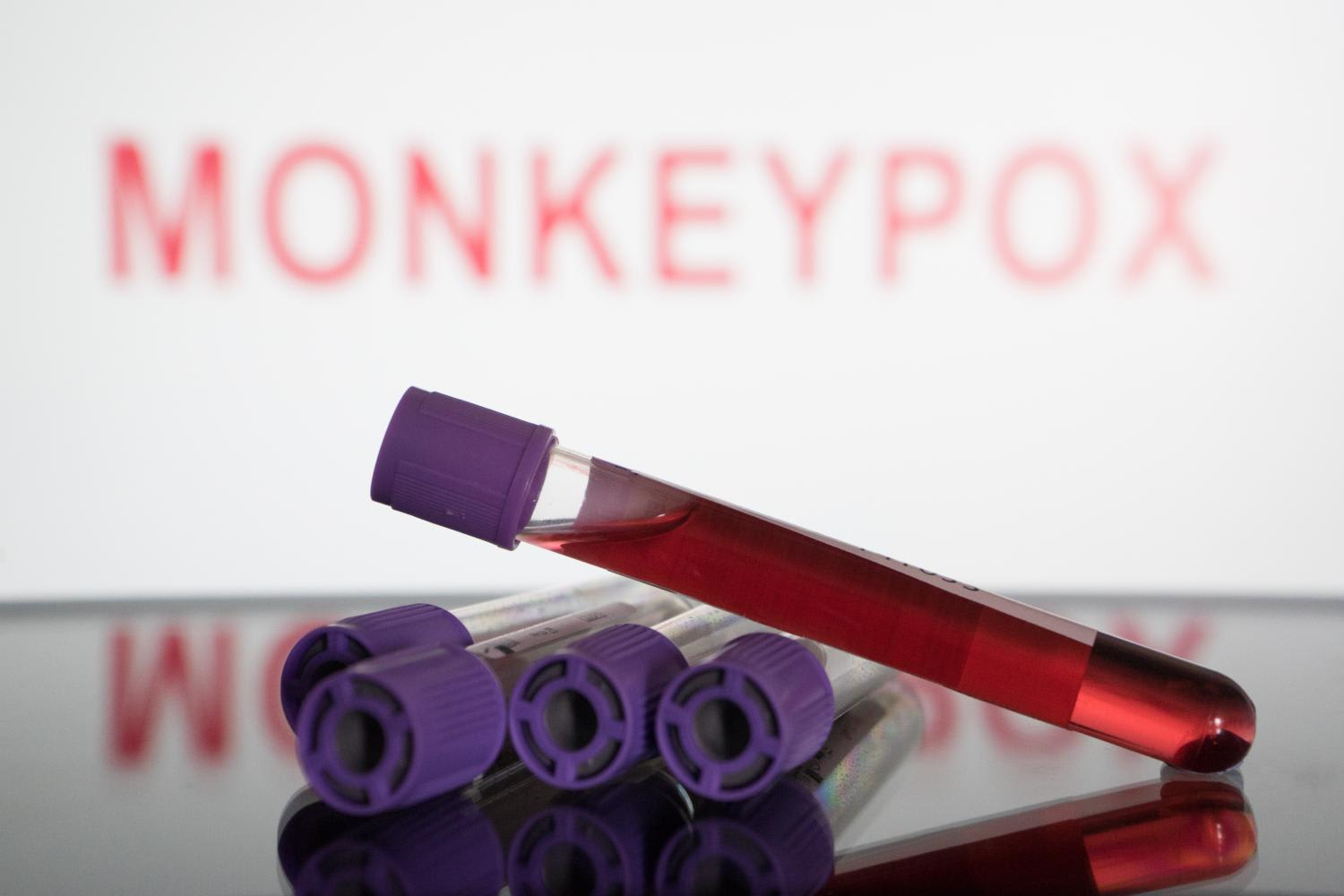 20220623_reuters_monkeypox