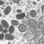 FILE – This 2003 electron microscope image made available by the Centers for Disease Control and Prevention shows mature, oval-shaped monkeypox virions, left, and spherical immature virions, right, obtained from a sample of human skin associated with the 2003 prairie dog outbreak. (Cynthia S. Goldsmith, Russell Regner/CDC via AP, File)