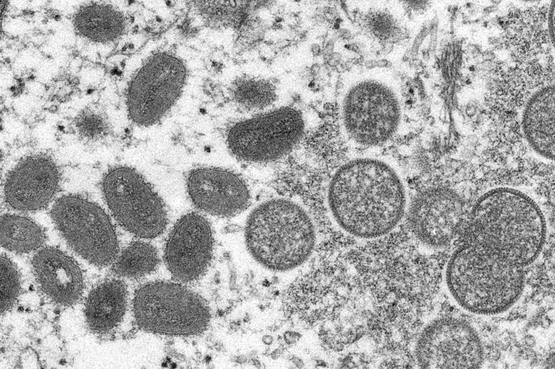 FILE – This 2003 electron microscope image made available by the Centers for Disease Control and Prevention shows mature, oval-shaped monkeypox virions, left, and spherical immature virions, right, obtained from a sample of human skin associated with the 2003 prairie dog outbreak. (Cynthia S. Goldsmith, Russell Regner/CDC via AP, File)