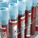 HIV-AIDS-virus
