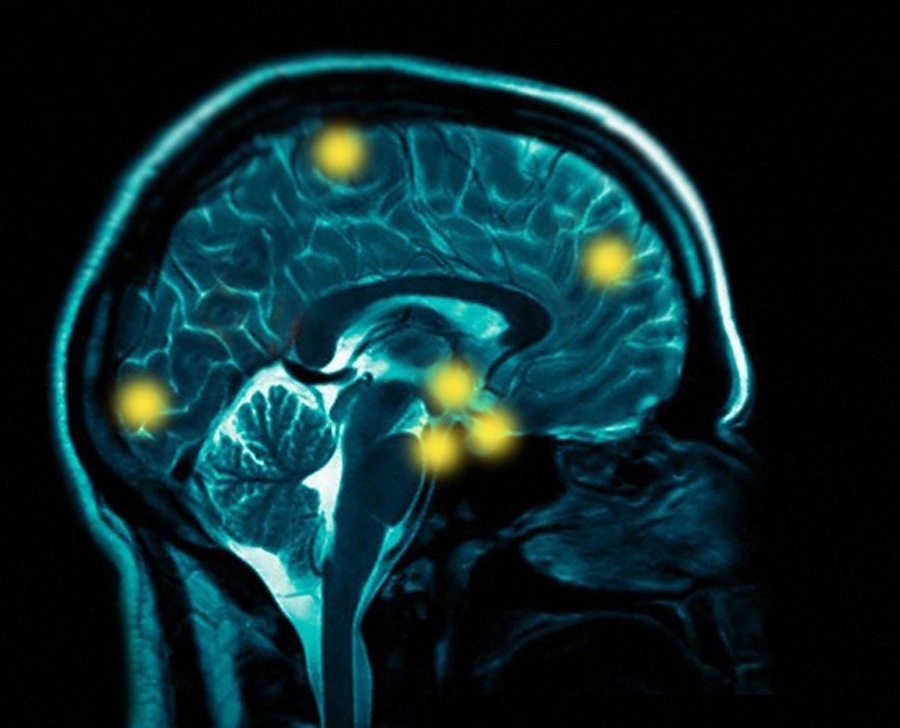 healthy-brain