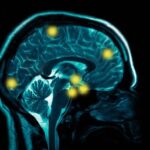healthy-brain