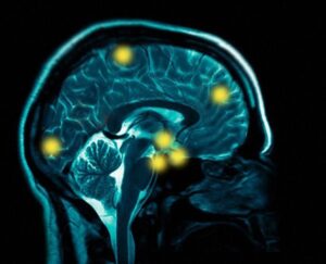 healthy-brain
