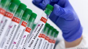 Indonesia confirms first monkeypox case in citizen returning from abroad