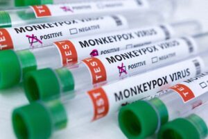 Test tubes labeled “Monkeypox virus positive and negative” are seen in this illustration taken May 23, 2022. REUTERS/Dado Ruvic/Illustration/File Photo