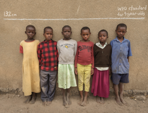 Reasons for high number of stunted children in Nigeria