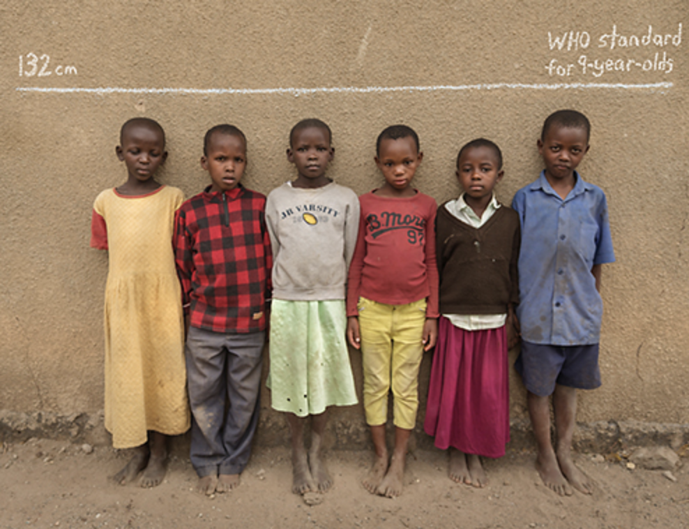 Reasons for high number of stunted children in Nigeria