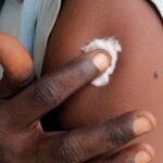 Sudan: Country’s first case of monkeypox detected in Darfur