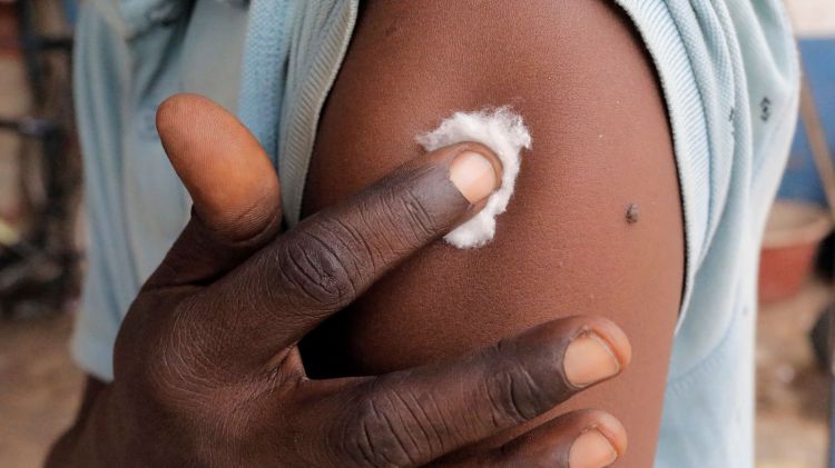 Sudan: Country’s first case of monkeypox detected in Darfur
