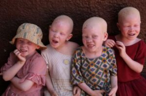 The EU and Albino Foundation