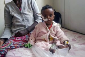 Yordanos Mebrahtiu, 1, is treated for malnutrition at the Ayder Referral Hospital in Mekele, in the Tigray region of northern Ethiopia Tuesday, Oct. 4, 2022. Babies are dying in their first month of life at four times the rate they did before the war in Ethiopia’s Tigray region, according to a yet-unpublished study shared by its authors with The Associated Press. (AP Photo)