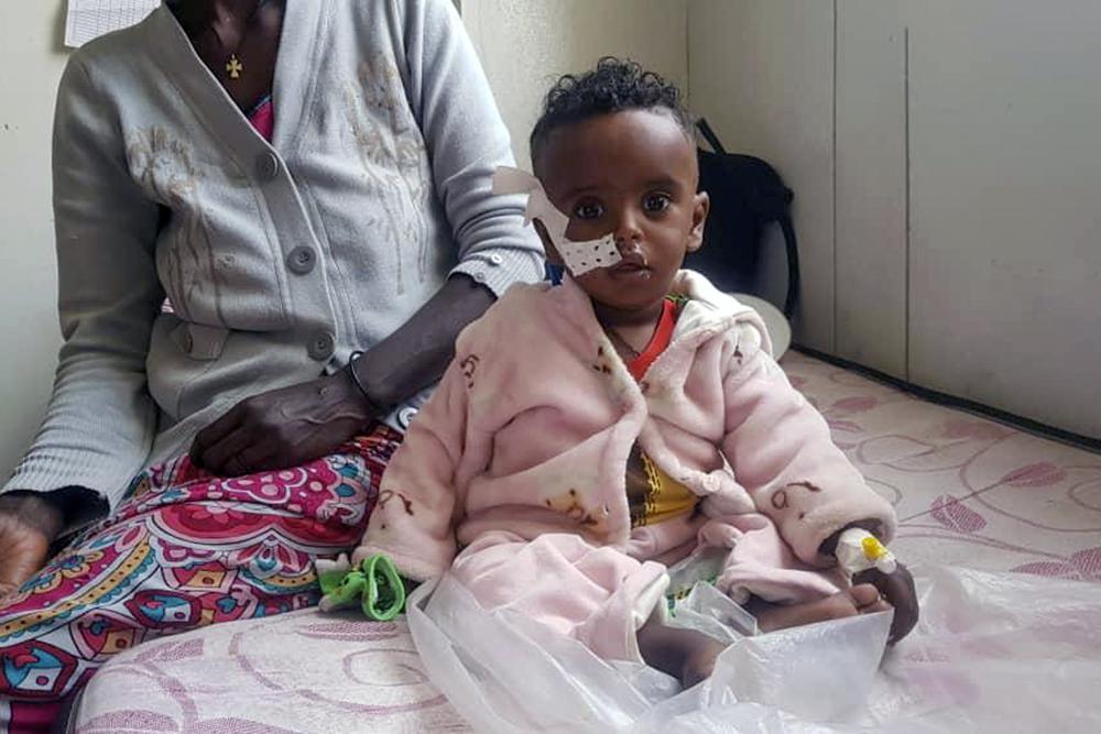 Yordanos Mebrahtiu, 1, is treated for malnutrition at the Ayder Referral Hospital in Mekele, in the Tigray region of northern Ethiopia Tuesday, Oct. 4, 2022. Babies are dying in their first month of life at four times the rate they did before the war in Ethiopia’s Tigray region, according to a yet-unpublished study shared by its authors with The Associated Press. (AP Photo)