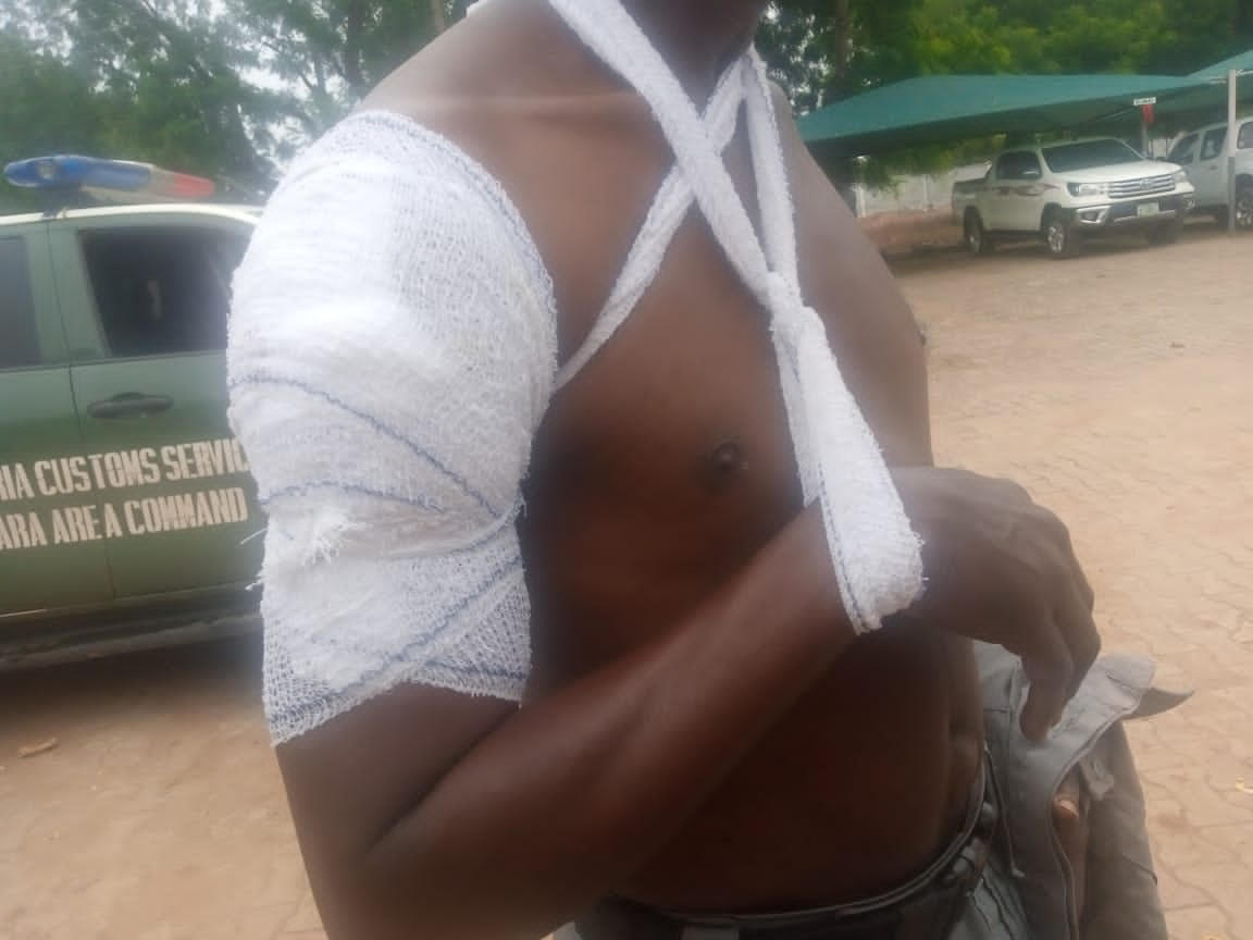 Smugglers kill 1, injure 3 Customs officers in Kwara