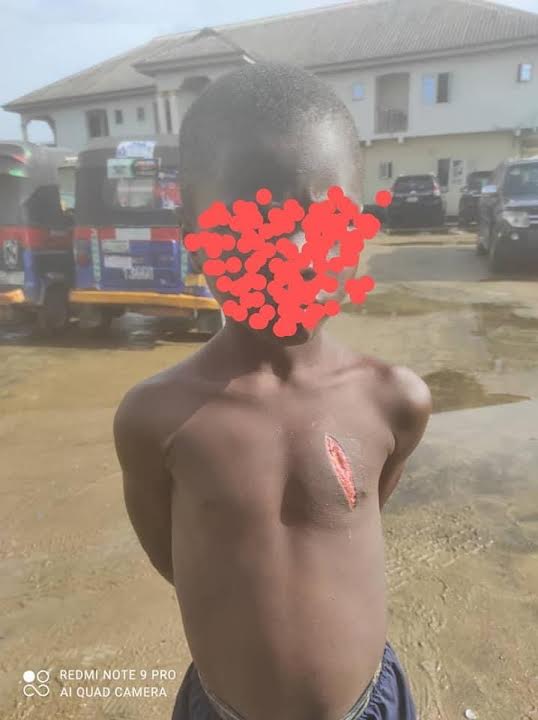 Bayelsa police arrest father for assaulting 9-year-old son