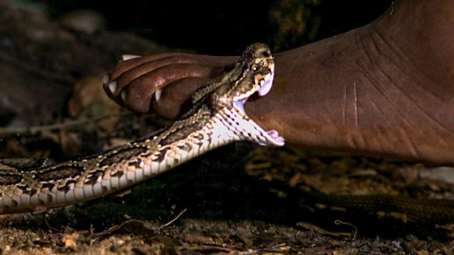 Snake-bite