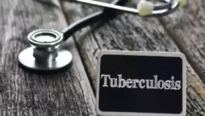  tuberculosis 
