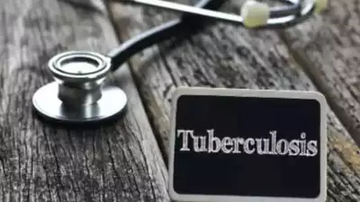  tuberculosis 
