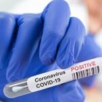 Coronavirus-COVID-19-positive
