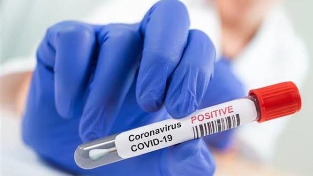 Coronavirus-COVID-19-positive