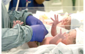 preterm-babies