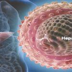 Hapatitis