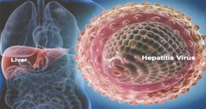 Hapatitis