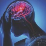 Brain