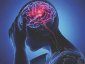 Brain
