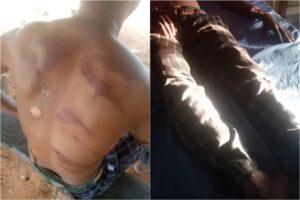 Ebonyi-Benue community boils, scores injured