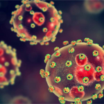 Lassa Fever