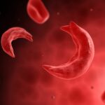 Sickle-Cell