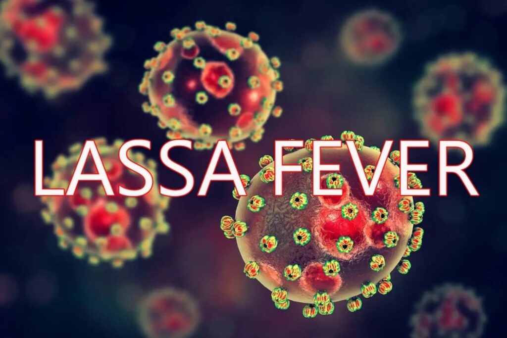 LASSA FEVER