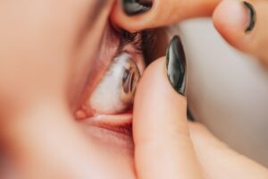 contact-lens
