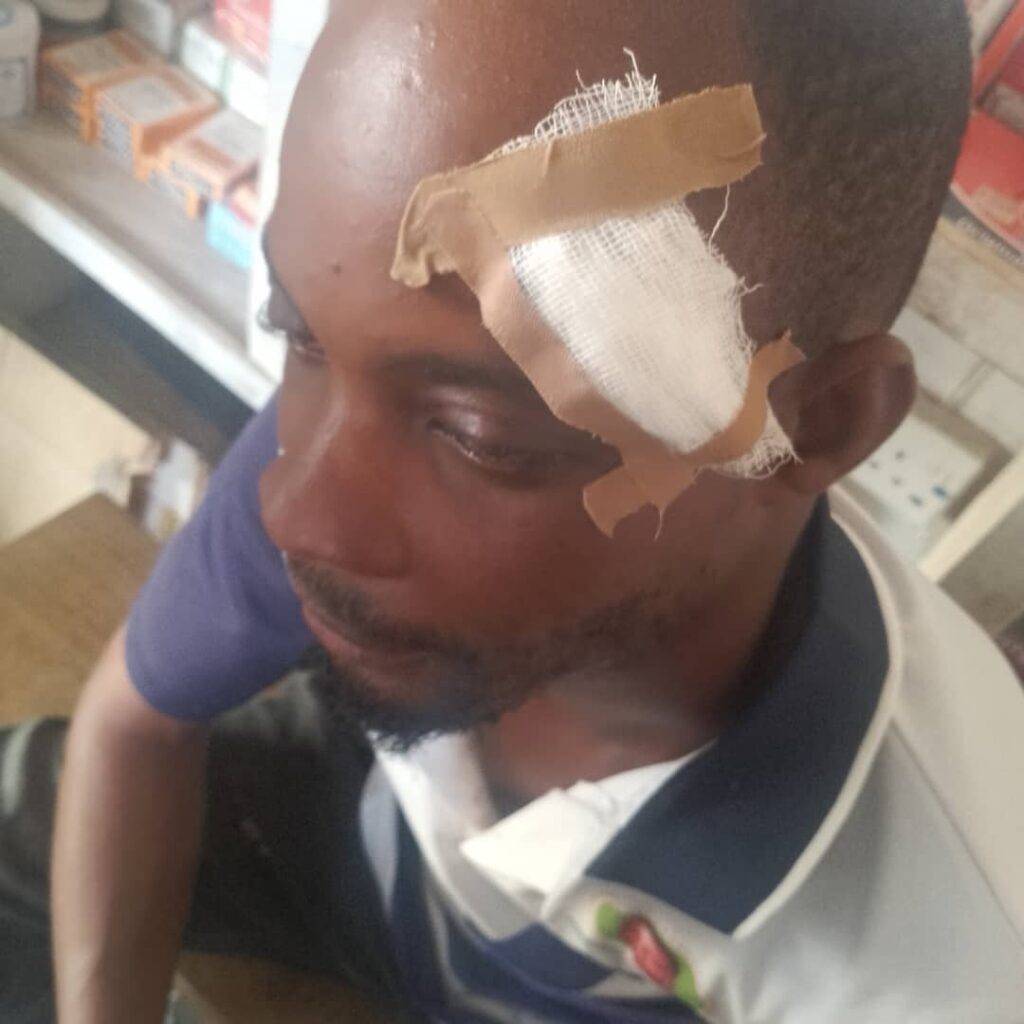 Ebonyi: Thugs attack e-ticketing officers, four injured