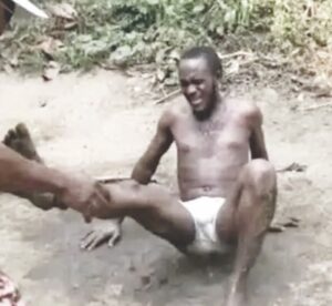 •Akpabio being tortured